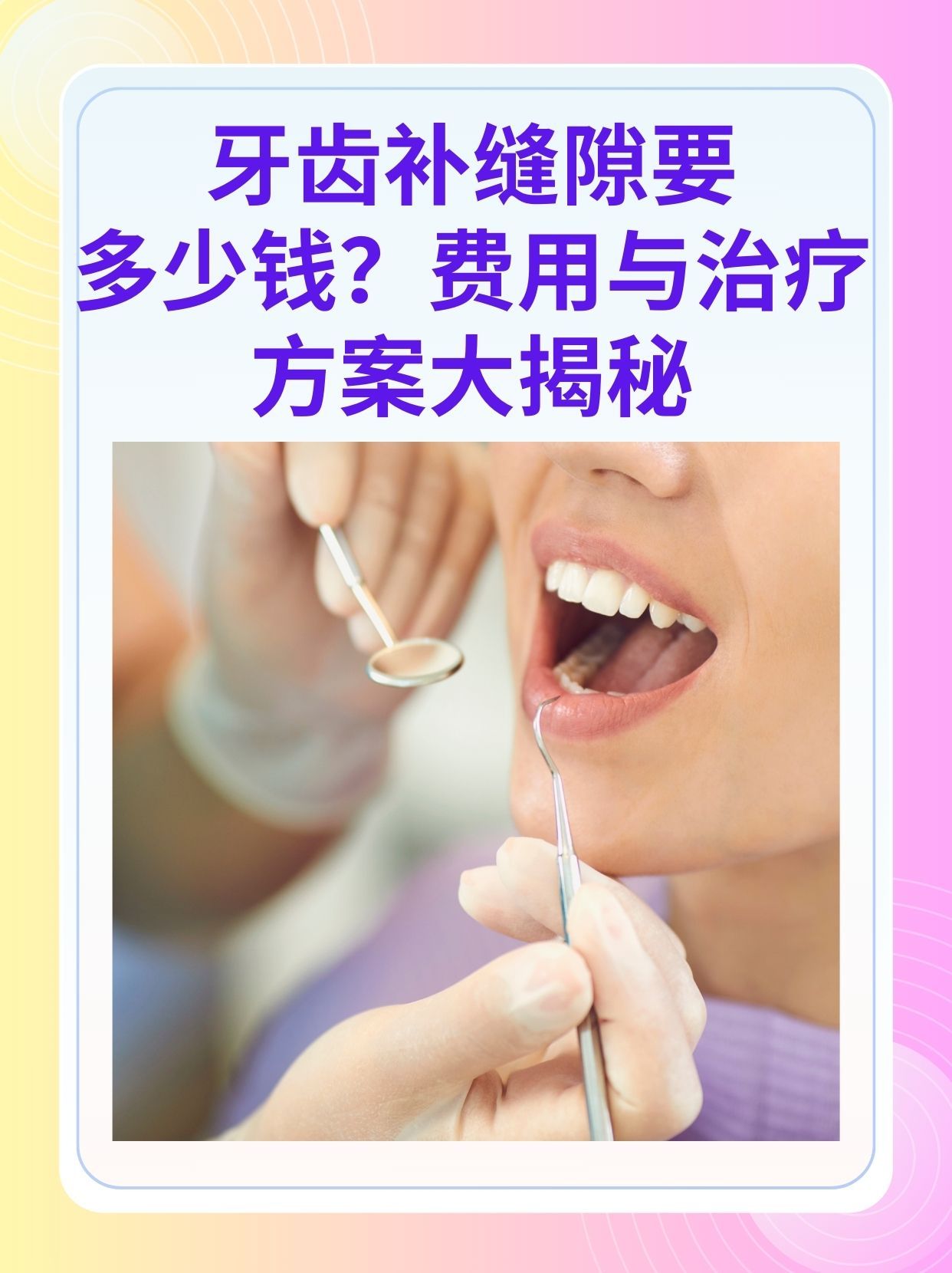 本溪补牙医保可以报销吗(补牙医保可以报销吗 哪些可以报销呢)